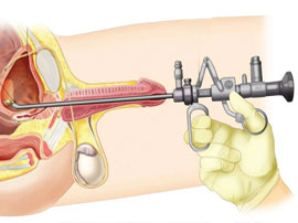 endoscopia